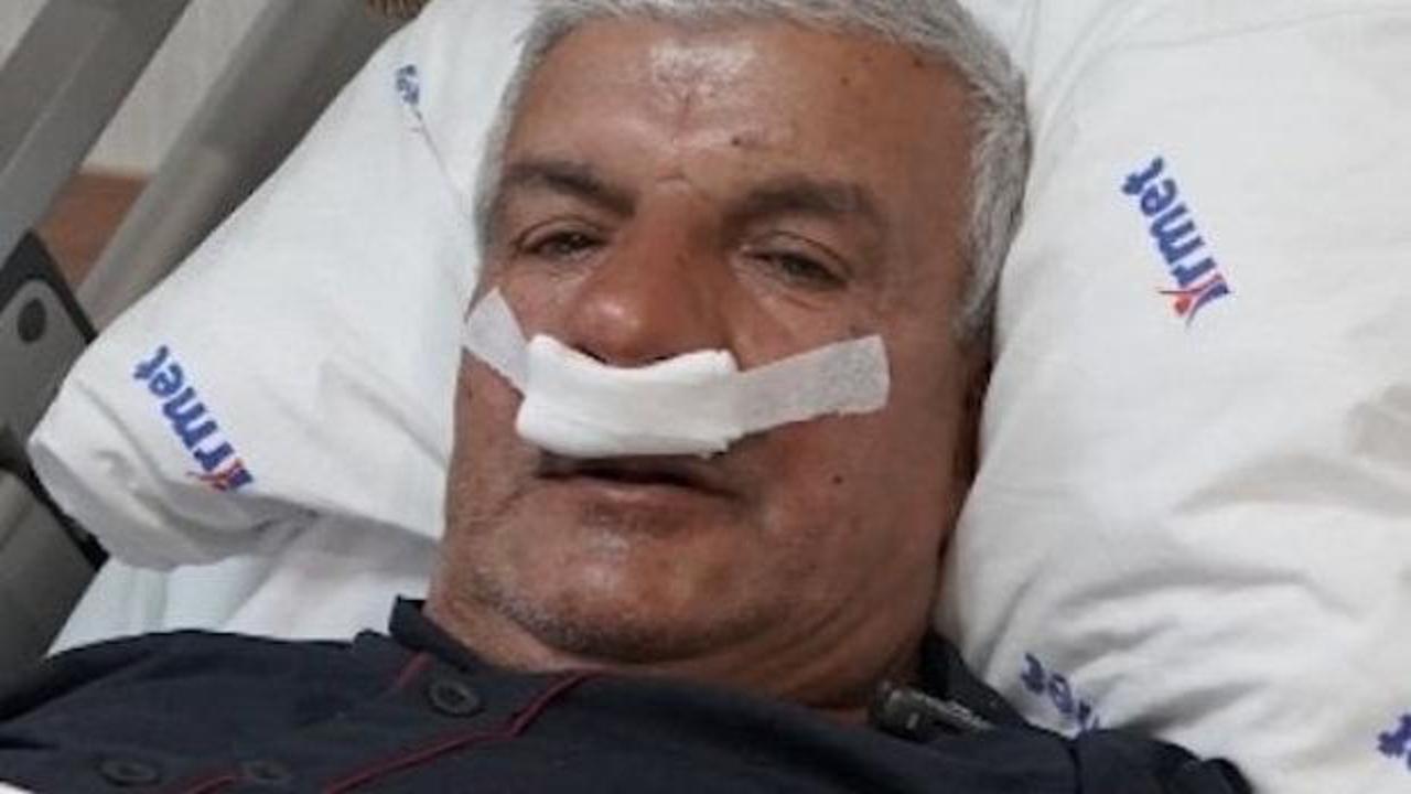 27 yıllık mesleğin şaşırtan sonucu: Burnundan 100 gramlık taş çıktı