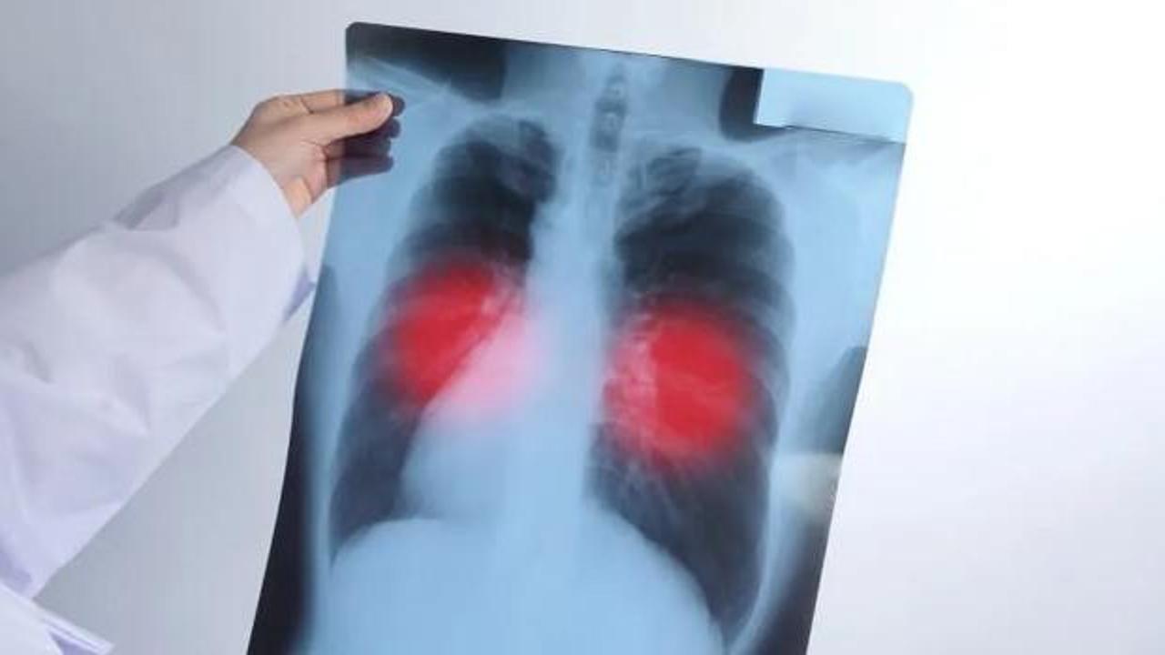 Akciğerinize kalıcı zarar veriyor! Siz de sık sık yaşıyorsanız dikkat