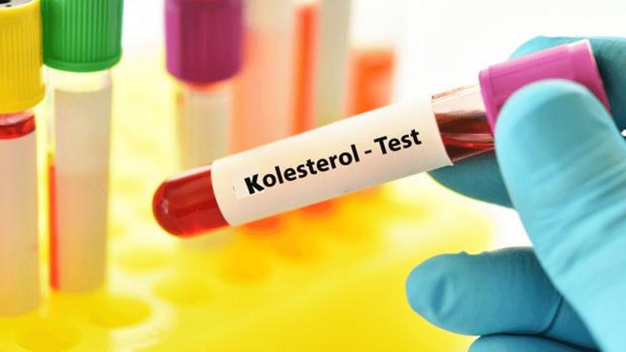 Bu besinler kolesterolünüzü düşürüyor! Yiyenlerin imdadına yetişiyor