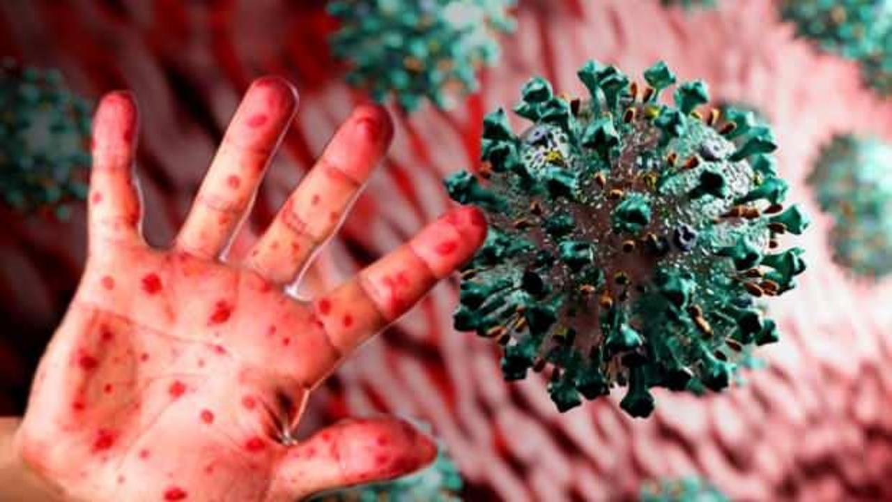 DSÖ son dakika duyurdu! 10 yıl sürebiliyor: Halk sağlığı acil durumu ilan edildi