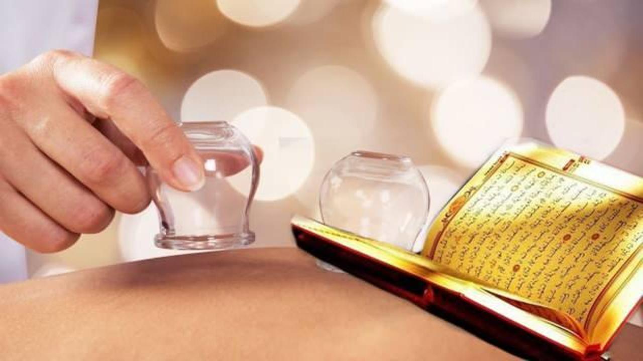 Manevi hacamat bölgeleri ve hacamatın faydaları! Hacamat sünnet mi, noktaları neler?