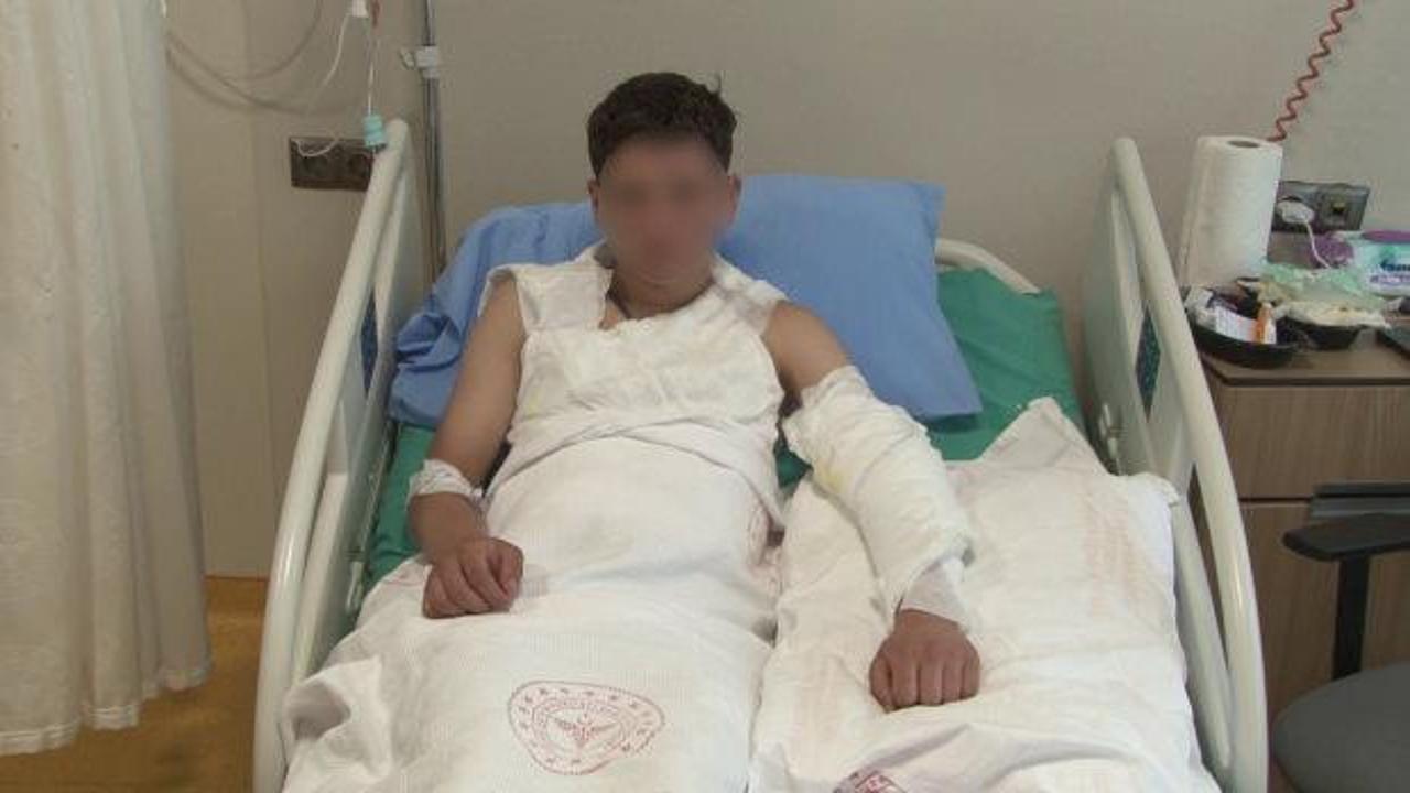 Merakı başına iş aştı! Vücudunun yüzde 25'i yandı... Kolonya şişesi bomba gibi patladı