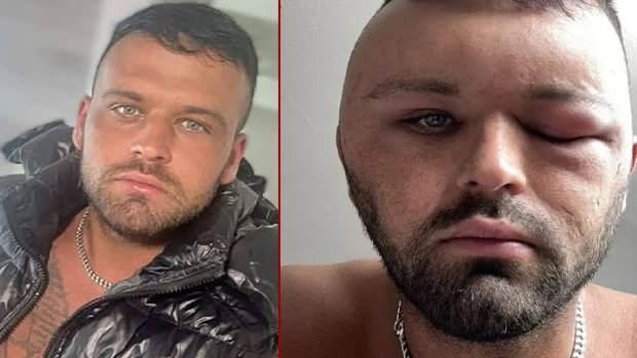 Saçını boyadı, neye uğradığını şaşırdı! Yüzü tanınmaz halde