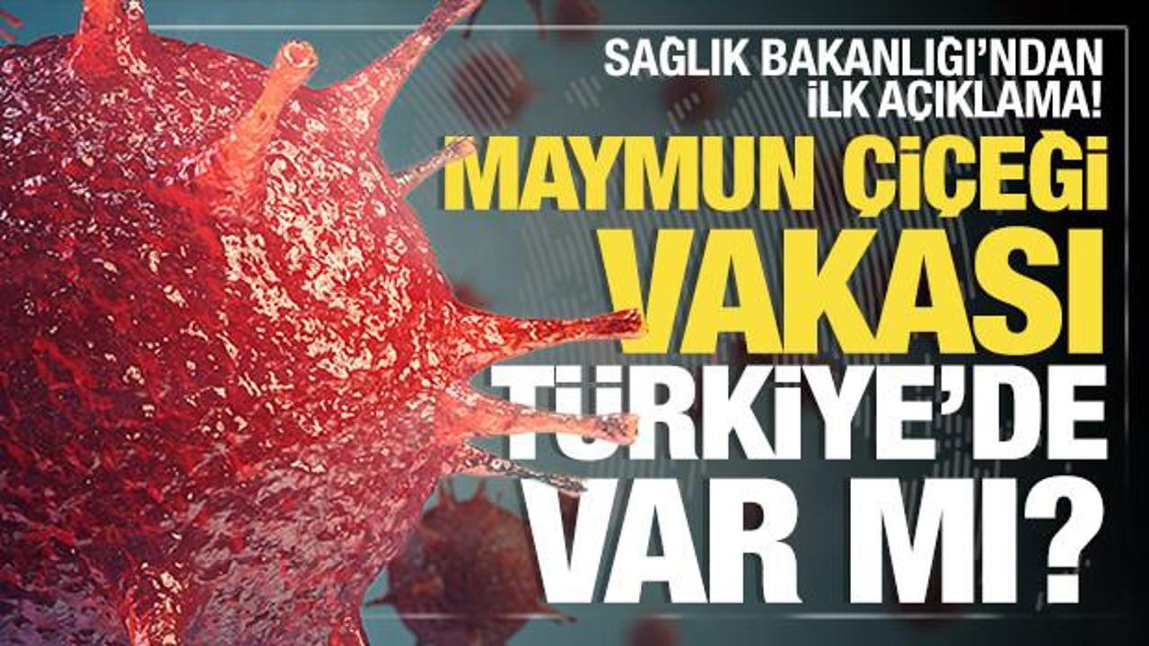 Sağlık Bakanlığı'ndan 'M çiçeği virüsü' açıklaması: Türkiye'de rastlandı mı?